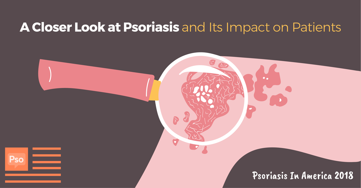 Why Does It Have to Be so Complicated? A Closer Look at Psoriasis and ...