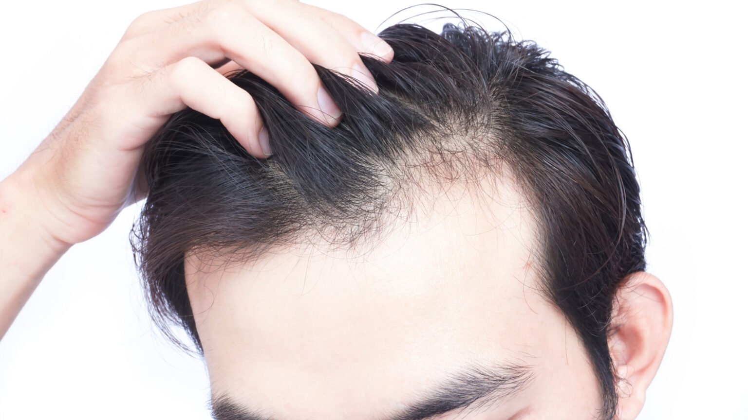 Why is My Hair Thinning?