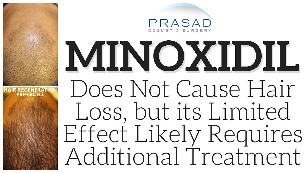 Why Minoxidil Doesn