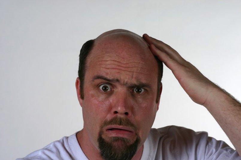 Will there ever be a permanent cure for hair loss?