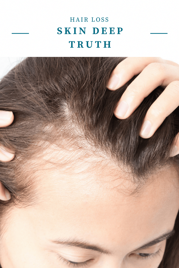 Women hair loss can be terrifying. Here are the most usual causes for ...