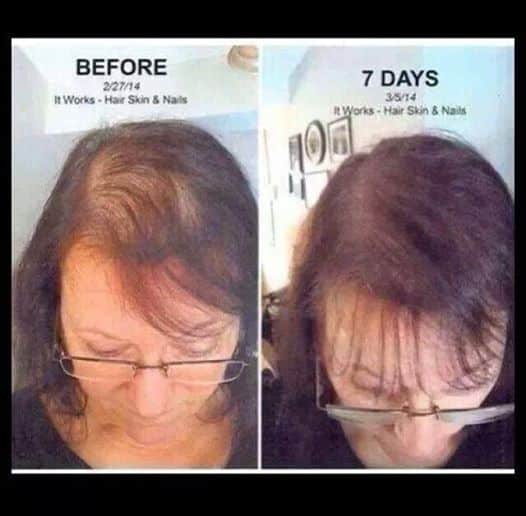 Women with thinning hair finally getting results with Hair Skin &  Nails ...