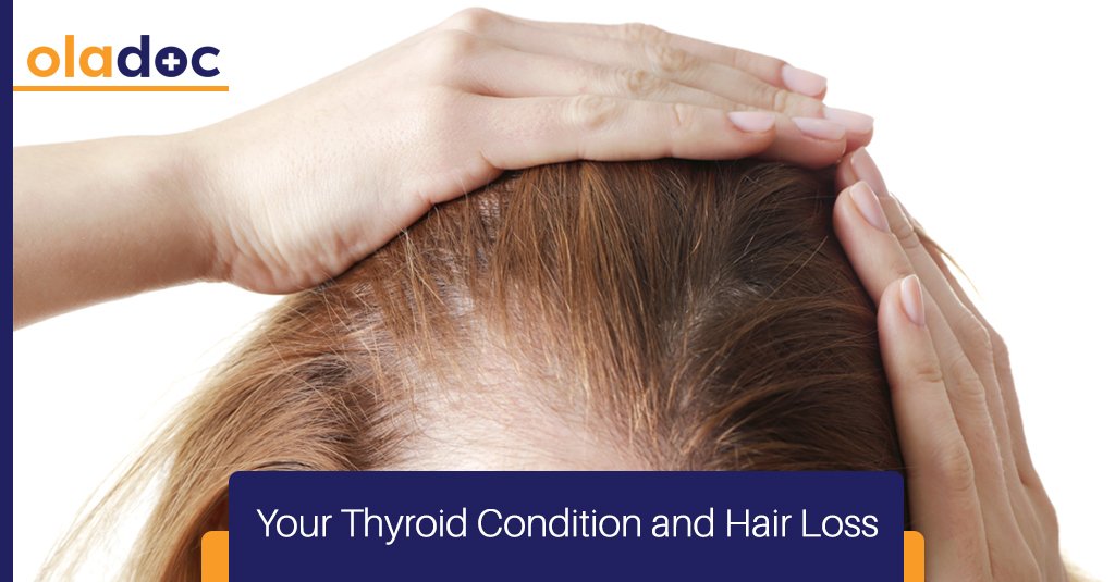 Your Thyroid Condition and Hair Loss